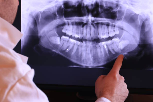 Best Emergency Treatment for Dental Infections or Abscesses in Andalusia, IL